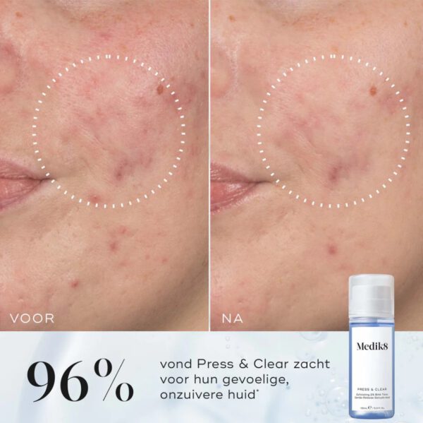 Schermafbeelding 2026-06-07 182230 Press & Clear™