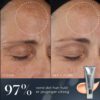 Crystal Retinal 10