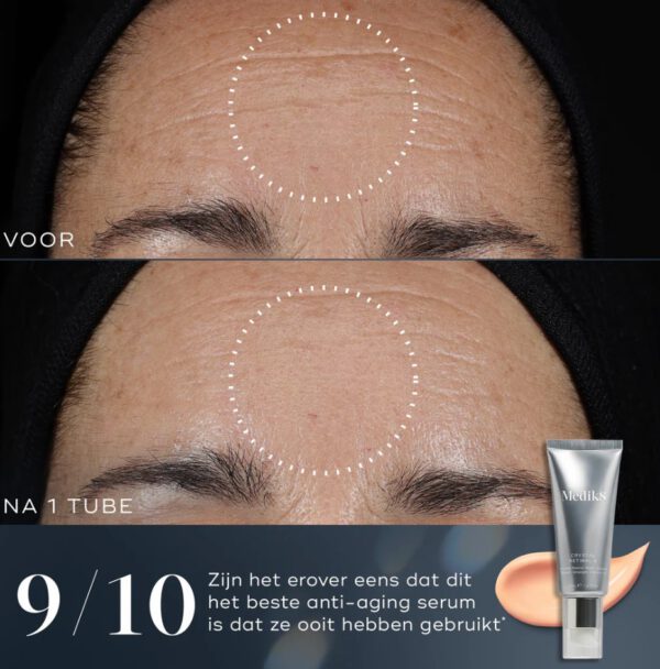 Crystal Retinal 10
