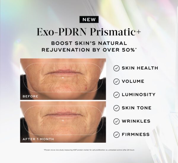 Exo-PDRN Prismatic+